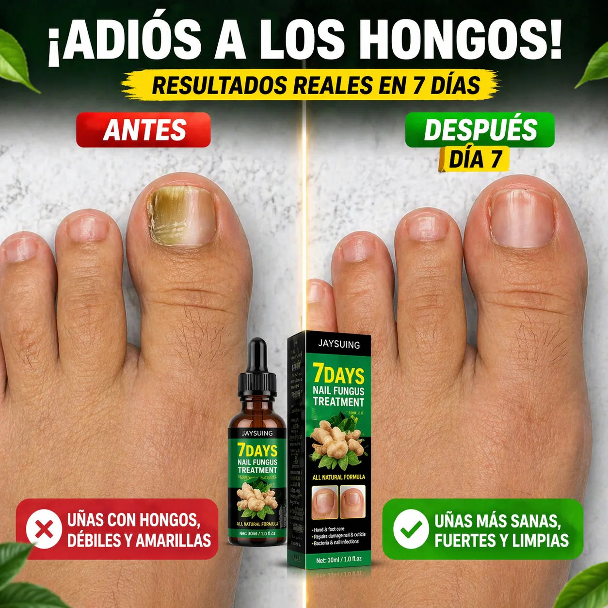 TRATAMIENTO ANTI HONGOS 100% NATURAL 7 DIAS (1+1 GRATIS) 30ML